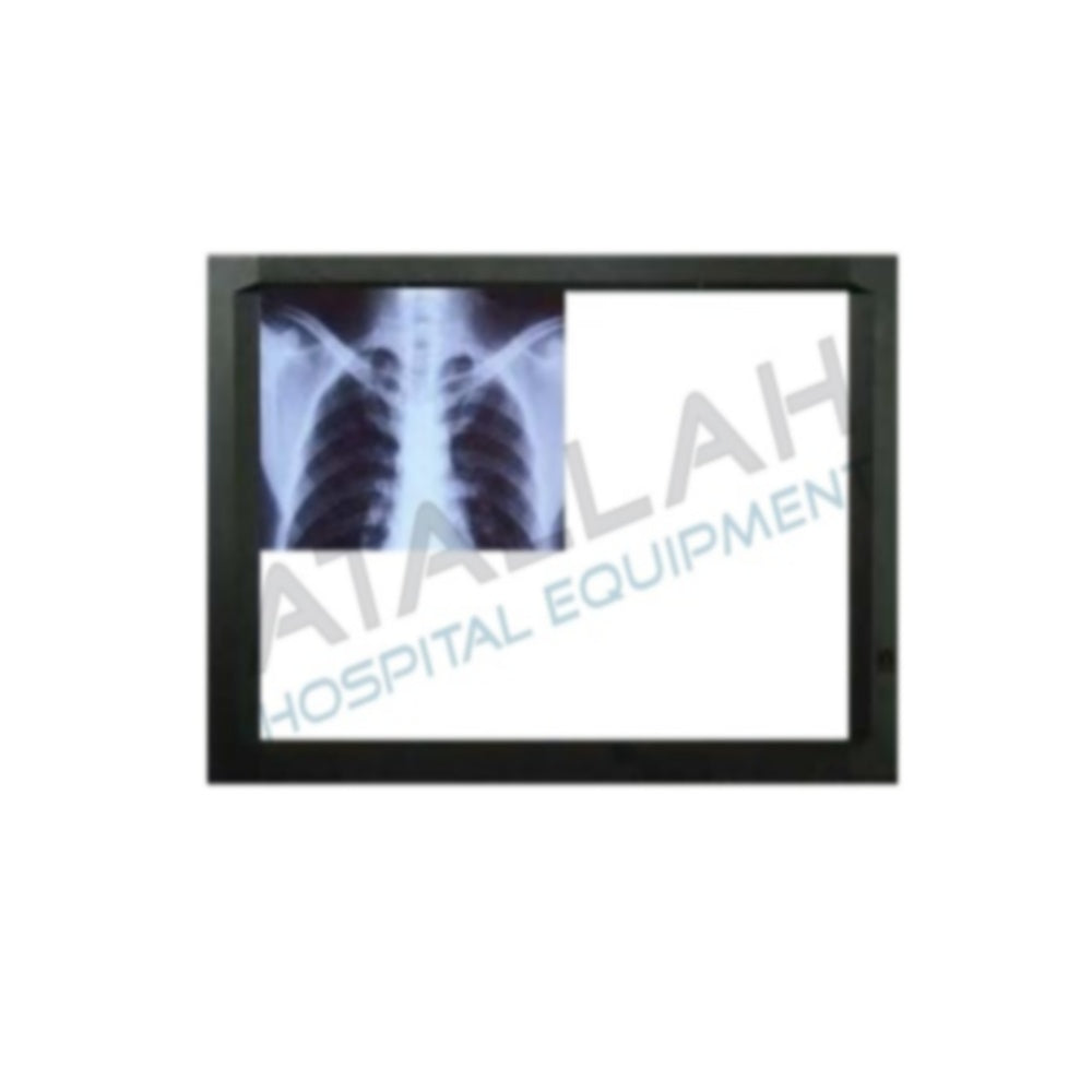Xray Viewer - Single Led